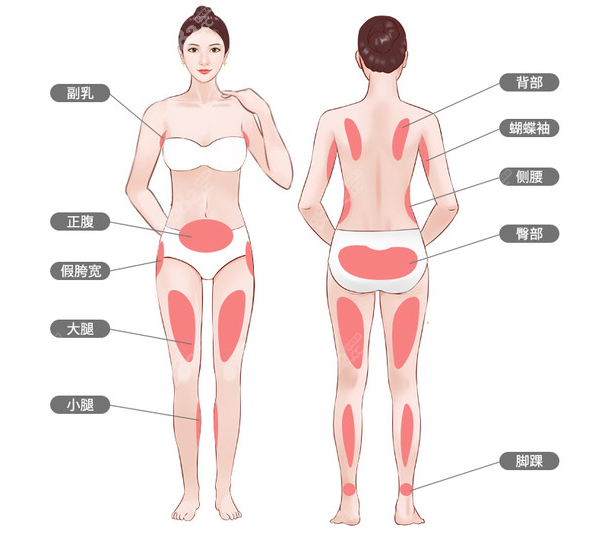 威塑吸脂做自体脂肪填充好处有哪些 8682.cc