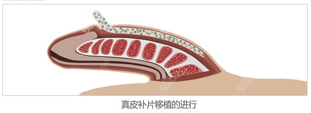 韩国世檀塔增粗图片