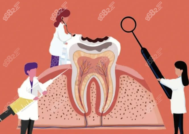 广州广大口腔医院根管治疗价格-8682网站