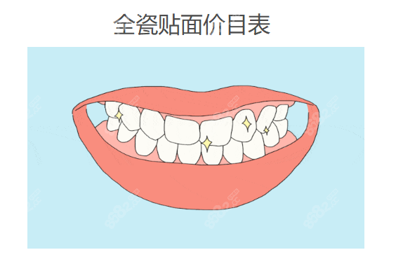 全瓷牙贴面价目表