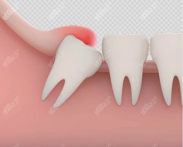 智齿的生长位置