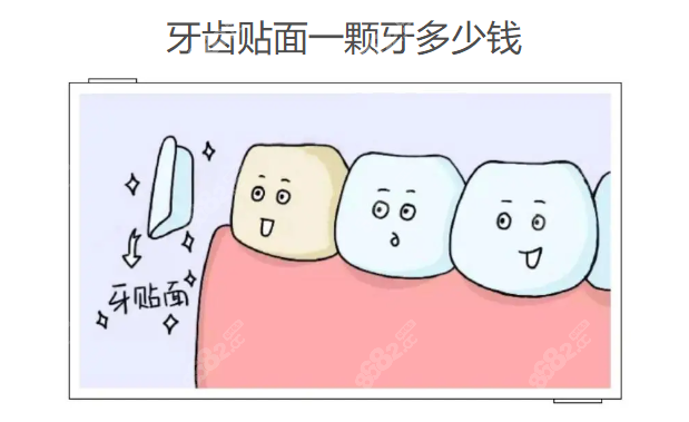 牙齿贴面一颗牙多少钱www.8682.cc