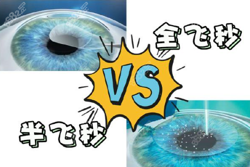 近视眼手术全飞秒和半飞秒哪个更好？