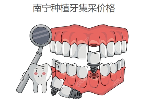 南宁种植牙集采价格