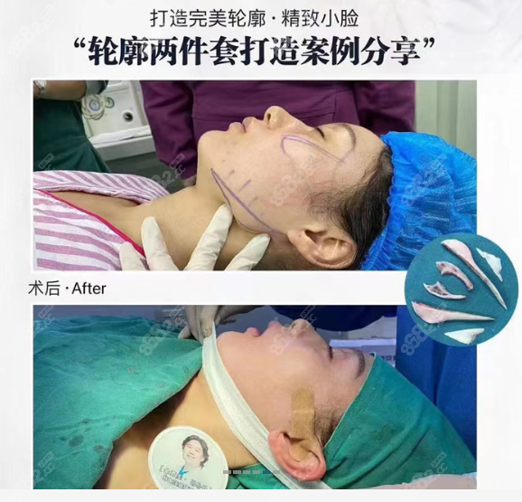 韩国金勇圭医生在韩国技术怎么样