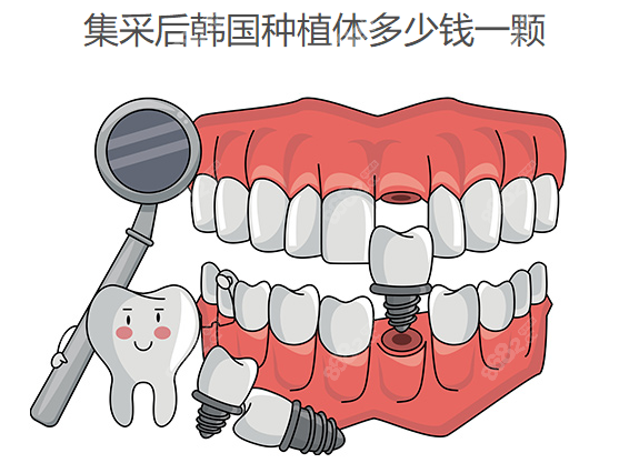 集采后韩国种植体多少钱一颗www.waasee.com