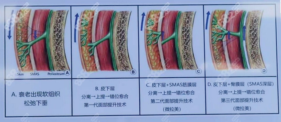 广州中家医家庭医生朱云医生微拉美提升技术好