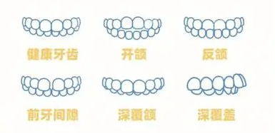 儿童矫正牙齿的费用6000元起