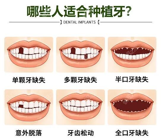 罗湖区种植牙医院排名