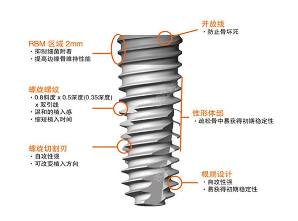 奥齿泰要略优于大清西格