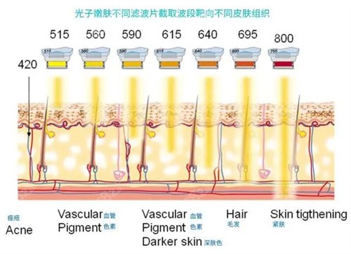 光子嫩肤通过不同波长达到不同目的