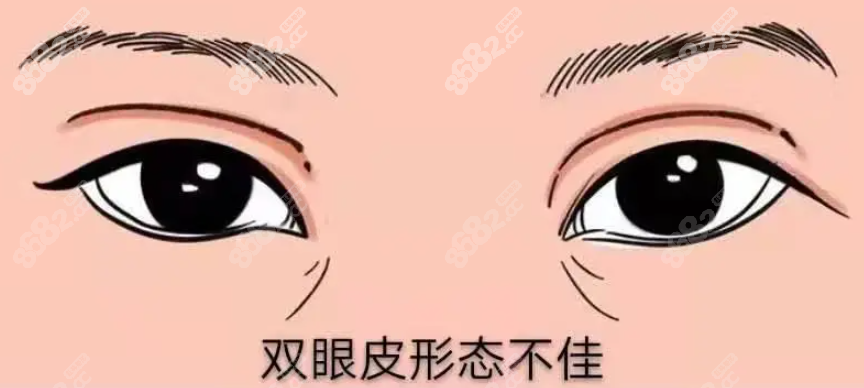 眼修复类型