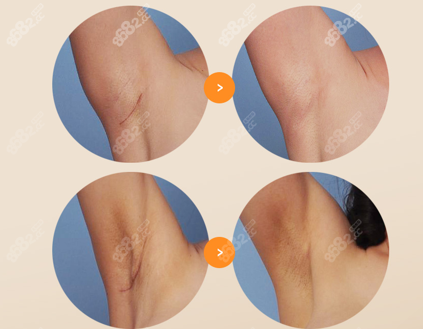 玉在鎮(zhèn)隆胸沒疤痕@8682網(wǎng) 玉在鎮(zhèn)隆胸沒疤痕@8682網(wǎng)