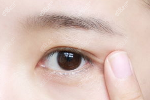 刘志刚医生做眼修复手术有没有失败的
