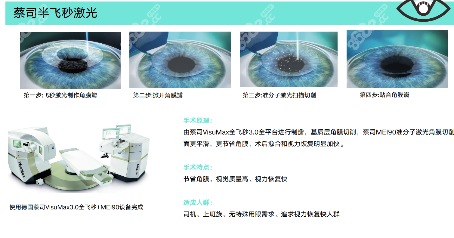 800度近视手术全飞秒、半飞秒和晶体植入区别
