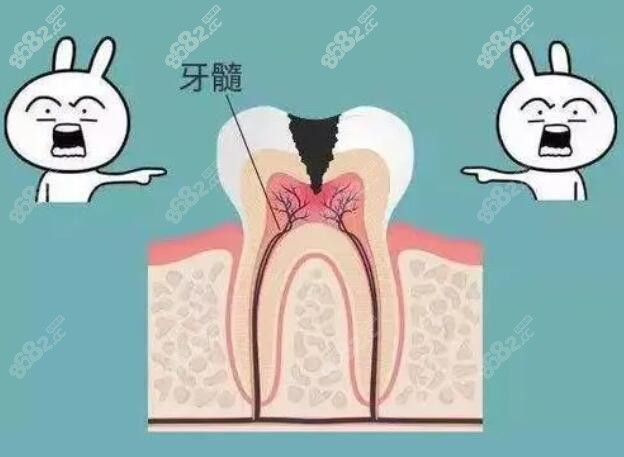 牙髓坏掉需要做根管治疗www.8682.cc