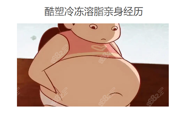 酷塑冷冻溶脂亲身经历www.8682.cc
