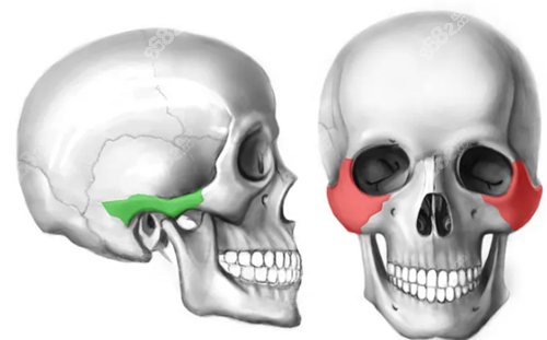 颧骨手术部位