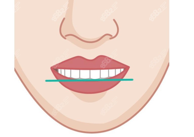 揭阳牙博士口腔牙齿矫正优势