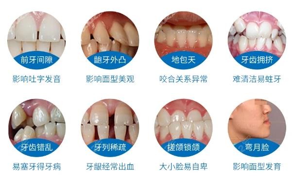 福州平潭口腔牙齿矫正价格表