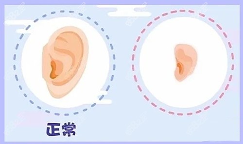 郑州耳畸形修复医院排名前三的公办医院www.8682.cc