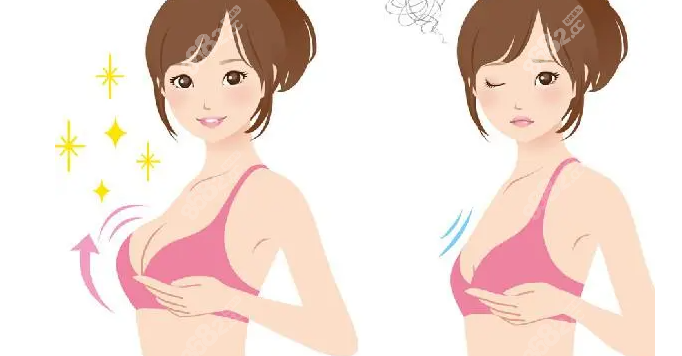 韩国假体隆胸技术怎么样
