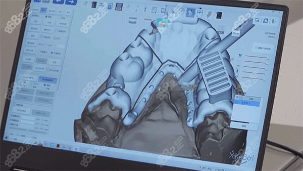 泉州柏德口腔种植牙机器人怎么样