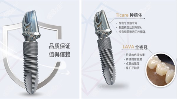 西班牙泰科ticare种植牙质量介绍