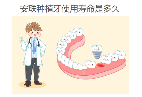 安联种植牙使用寿命是多久www.8682.cc