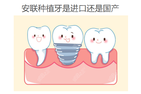 安联种植牙是进口还是国产
