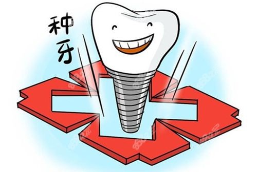 登腾和奥齿泰种植牙优劣对比