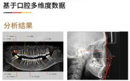 广州柏德口腔正畸技术好8682.cc