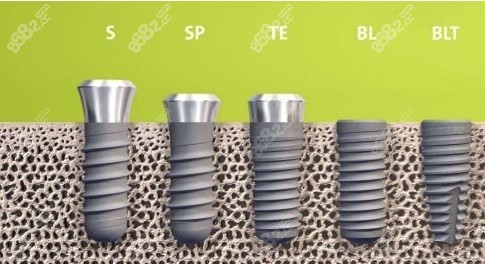 <!--<i data=20240705-sp></i>-->口腔种植牙怎么样