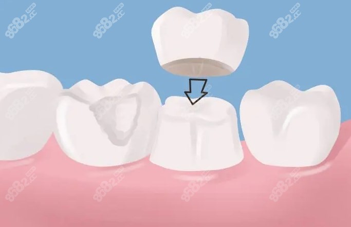 赣州牙博士口腔牙冠