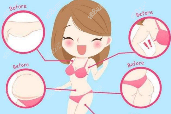 成都莱瑞拉整形医院抽脂怎么样