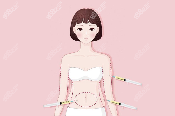 成都莱瑞拉整形医院抽脂怎么样