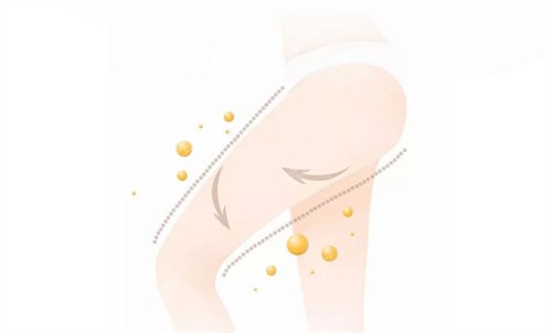 大腿抽脂动画展示图