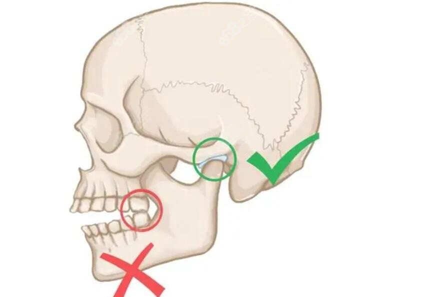 图德口腔颞下颌关节紊乱治疗