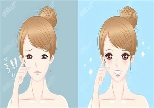 合肥維多利亞吳麗麗怎么樣？做大眼綜合好看價格9300起