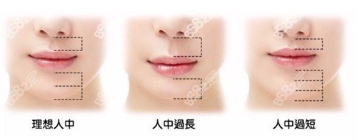 人中縮短術(shù)好的醫(yī)生