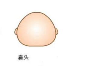 后脑勺骨水泥填充结果怎么样？