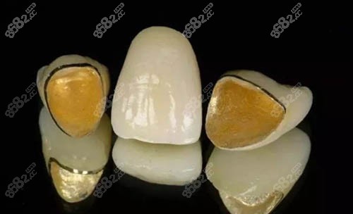全瓷牙材料照片