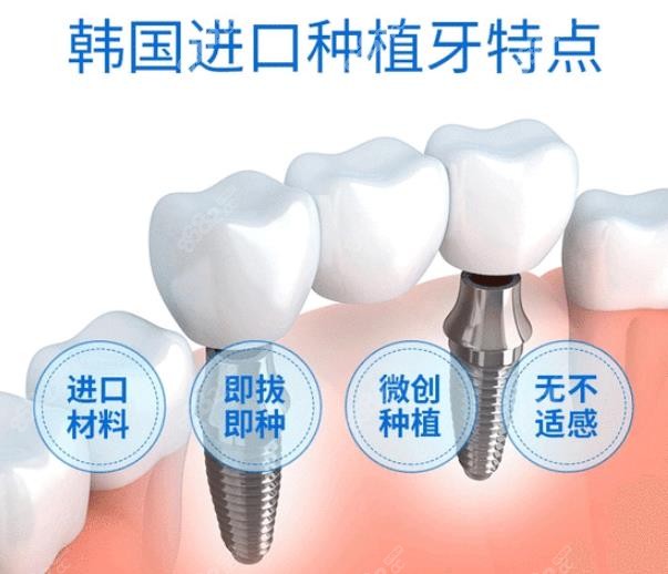 韩国种植牙价格多少钱一颗8682.cc