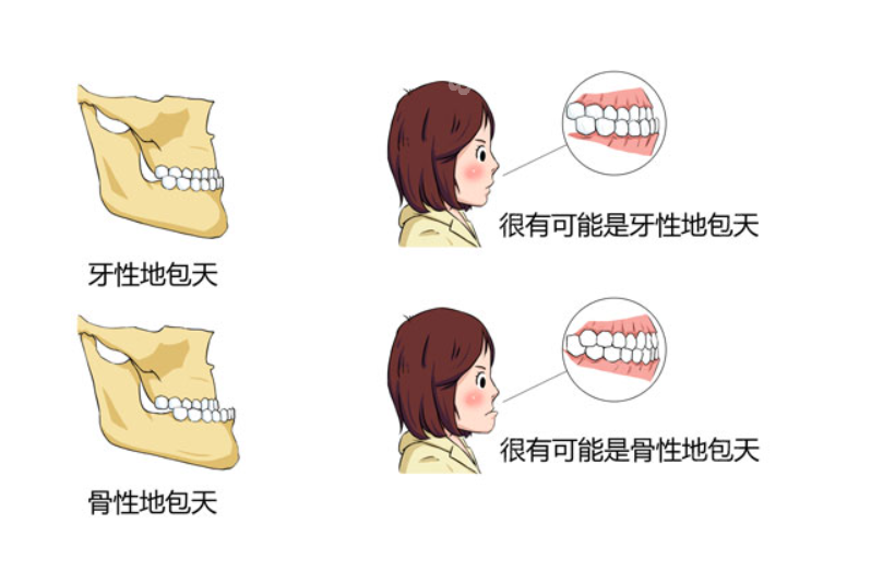 沈阳牙性/骨性反颌出名医院