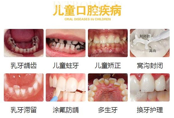 厦门登特儿童口腔医院费用