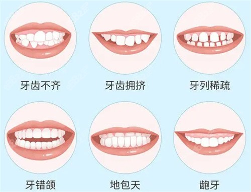 厦门登特口腔牙齿矫正价格参考