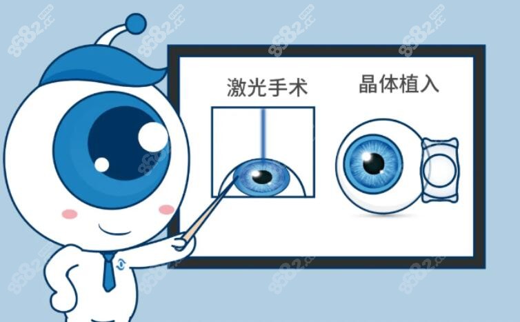 晶体植入手术方式