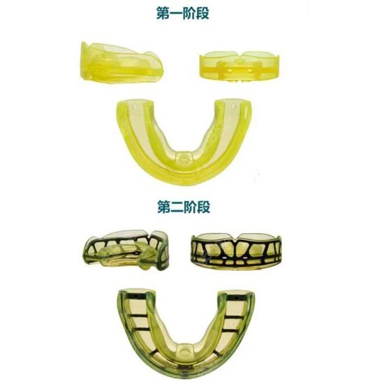 吕梁做儿童反颌矫正价格便宜品牌也不同www.8682.cc