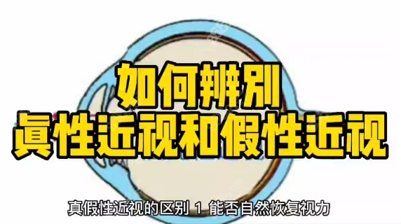 假性近视和真性近视的区别