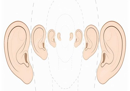 广州高尚做耳再造实力明显